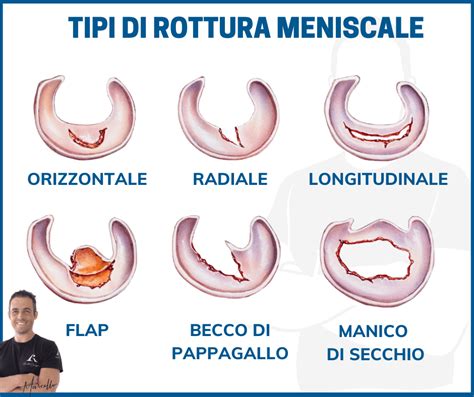 Anello rotto o perso: simboli di fragilità relazionale
